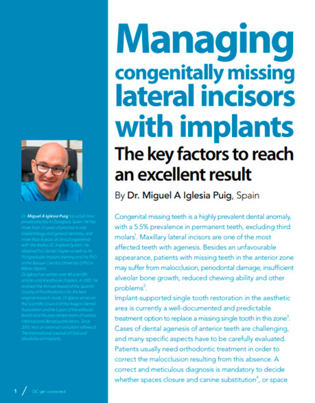 Managing congenitally missing lateral incisors with implants. The key factors to reach an excellent result